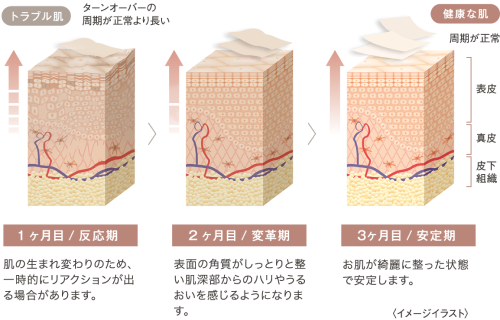 トラブル肌では、ターンオーバーの周期が正常より長く、健康な肌になるにつれて周期が正常になる。 1ヶ月目（反応期）では、肌の生まれ変わりのため、一時的にリアクションが出る場合があります。 2ヶ月目（変革期）では、表面の角質がしっとりと整い肌深部からのハリやうるおいを感じるようになります。 3ヶ月目（安定期）では、お肌が綺麗に整った状態で安定します。
